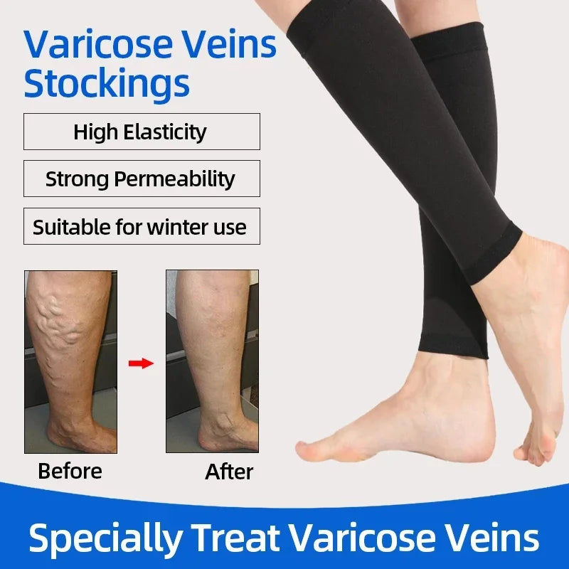 Compression Calf Sleeves – 20–30mmHg Support for Running & Recovery