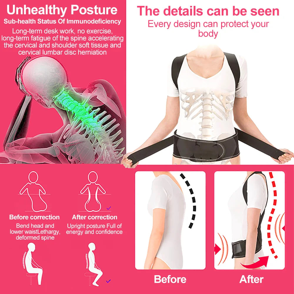 Back Posture Corrector – Spine & Shoulder Support Brace